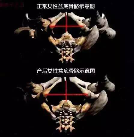 20170515130347_28670.png